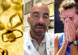 à gauche, cristaux d'acide urique, qui peuvent s'accumuler dans les reins, formant des calculs : selon Matteo Bassetti, ils pourraient être la cause des coliques subies par Gianmarco Tamberi aux Jeux Olympiques de Paris