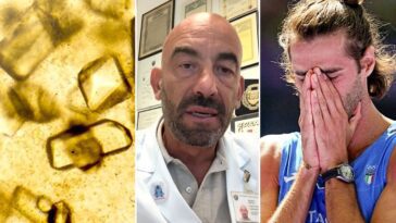 à gauche, cristaux d'acide urique, qui peuvent s'accumuler dans les reins, formant des calculs : selon Matteo Bassetti, ils pourraient être la cause des coliques subies par Gianmarco Tamberi aux Jeux Olympiques de Paris