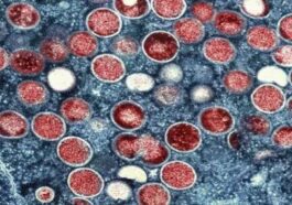 Particules de variole du singe (rouges) à l'intérieur d'une cellule infectée (bleue) / Crédit : National Institute of Allergy and Infectious Diseases (NIAID)