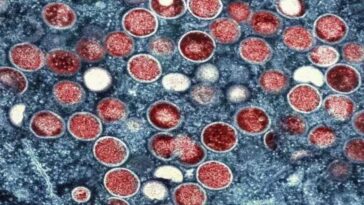 Variole des singes (mpox), l'OMS évalue l'état d'urgence pour la nouvelle souche plus létale 30 Particules de variole du singe (rouges) à l'intérieur d'une cellule infectée (bleue) / Crédit : National Institute of Allergy and Infectious Diseases (NIAID)