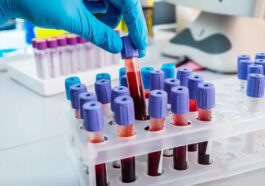 Easy blood test can predict a woman