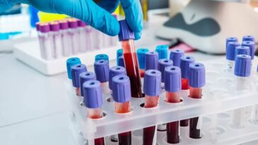 Un simple test sanguin peut prédire le risque de maladie cardiaque chez une femme des décennies à l'avance 18 Easy blood test can predict a woman