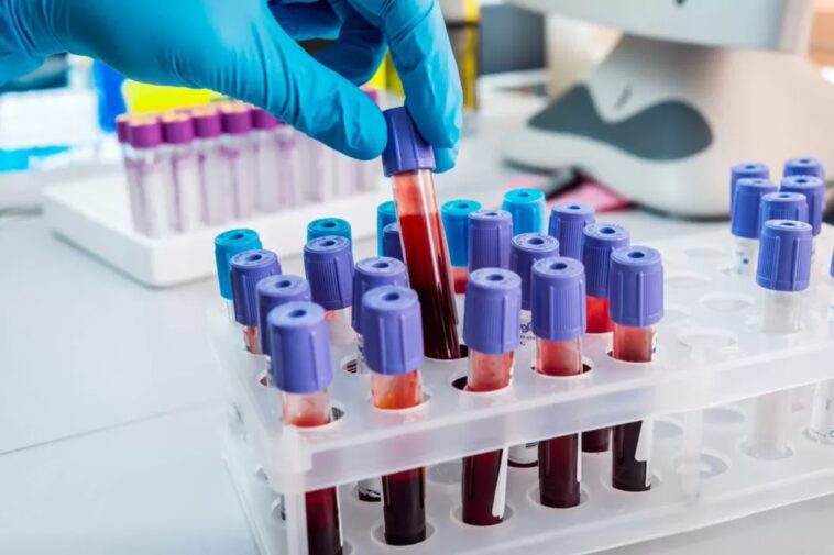 Un simple test sanguin peut prédire le risque de maladie cardiaque chez une femme des décennies à l'avance 1 Easy blood test can predict a woman