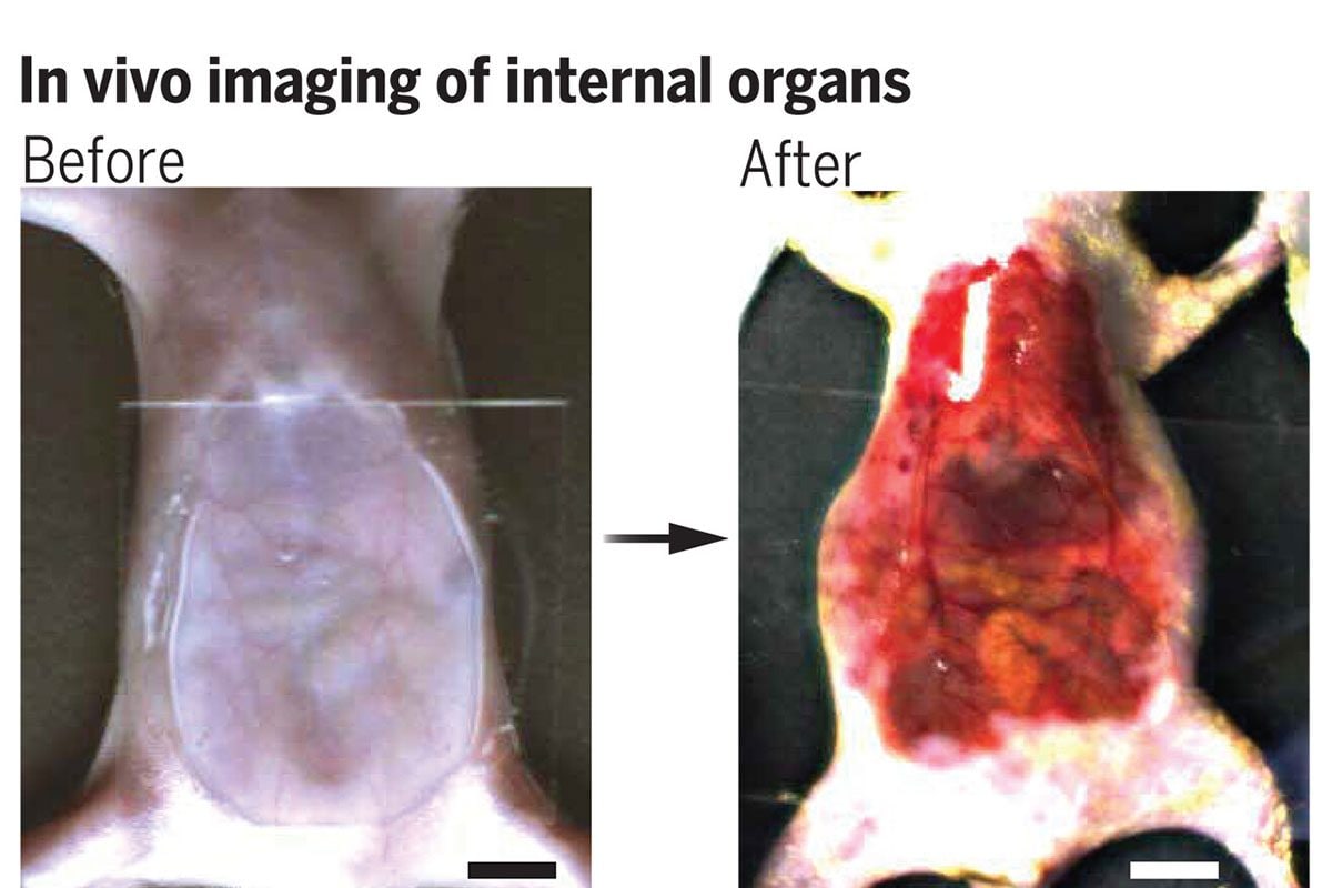 Un colorant alimentaire jaune rend la peau et les muscles transparents : le secret de l'invisibilité ? 3 Avant et après l'utilisation du colorant tartrazina sur l'abdomen d'un rongeur / Crédit : Ou z. et al. Science 2024.