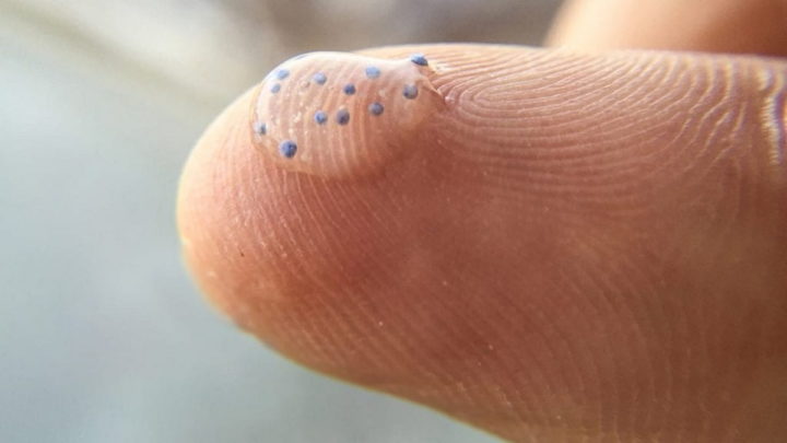 Nouveau study détecte des microplastiques dans le tissu cérébral humain 4 Microplásticos