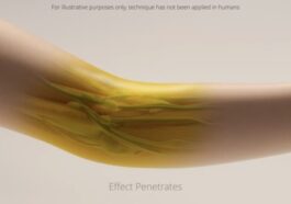 Image purement illustrative de peau humaine transparente