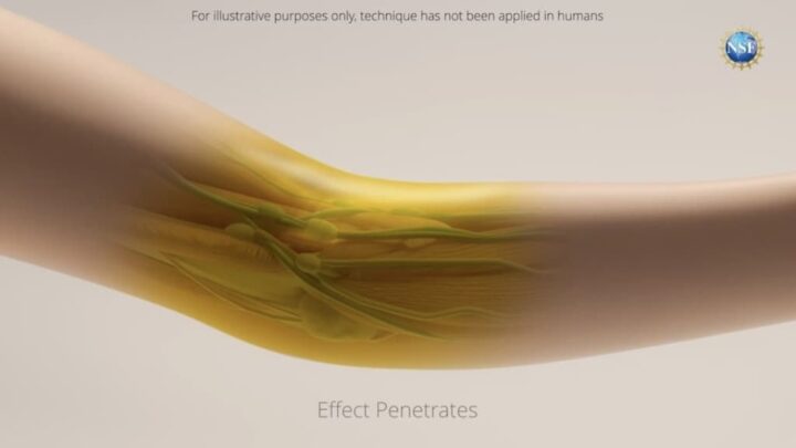 Cette expérience incroyable a réussi à rendre la peau transparente 2 Image purement illustrative de peau humaine transparente