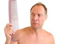 Des scientifiques ont découvert un sucre qui pourrait résoudre la calvitie masculine 25 Calvitie