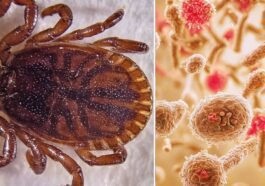Une tique Haemaphysalis concinna qui peut transmettre le virus des zones humides (WELV), le nouveau virus découvert en Chine / Crédit : Wikipedia/IStock