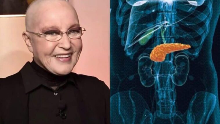 Quel est le taux de mortalité du cancer du pancréas, la maladie qui a emporté Eleonora Giorgi : une hausse alarmante des cas 1 Image