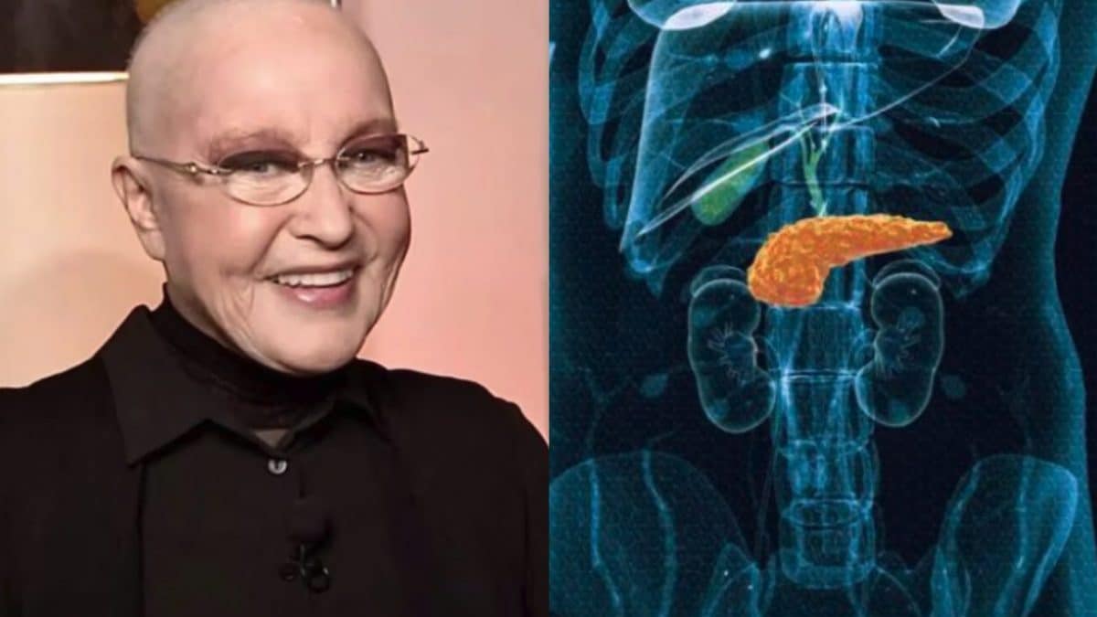 Quel est le taux de mortalité du cancer du pancréas, la maladie qui a emporté Eleonora Giorgi : une hausse alarmante des cas 2 Image