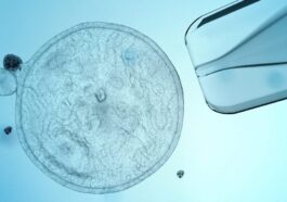 Le diabète de type 1 d'une femme traité pour la première fois avec des cellules reprogrammées pour produire de l'insuline 32 Les cellules souches (comme celle en photo) peuvent être utilisées pour faire croître n'importe quel type de tissu et peuvent être cultivées en laboratoire, ce qui signifie qu'elles offrent potentiellement une source illimitée de n'importe quel type de cellules : en utilisant les cellules d'une personne, d'abord converties en souches puis reprogrammées pour produire de l'insuline, les chercheurs expérimentent un traitement pour le diabète / Photo Credit: iStock