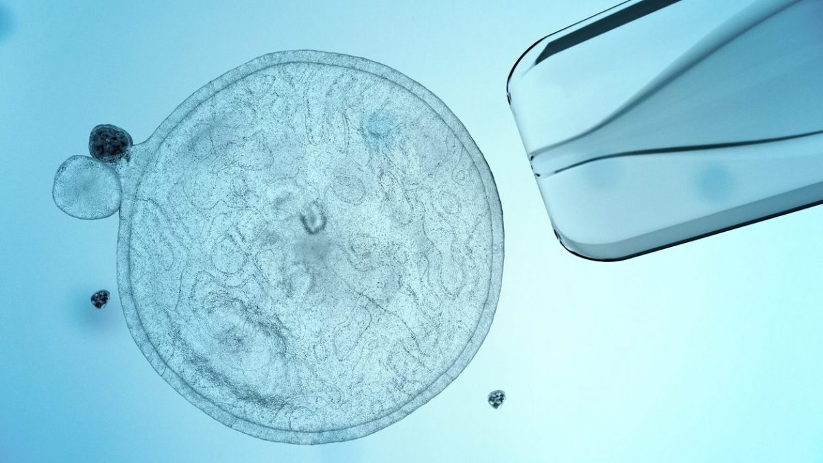 Le diabète de type 1 d'une femme traité pour la première fois avec des cellules reprogrammées pour produire de l'insuline 2 Les cellules souches (comme celle en photo) peuvent être utilisées pour faire croître n'importe quel type de tissu et peuvent être cultivées en laboratoire, ce qui signifie qu'elles offrent potentiellement une source illimitée de n'importe quel type de cellules : en utilisant les cellules d'une personne, d'abord converties en souches puis reprogrammées pour produire de l'insuline, les chercheurs expérimentent un traitement pour le diabète