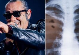 Quali sono i primi sintomi di un tumore al polmone e come ha fatto Luca Carboni a scoprire la malattia