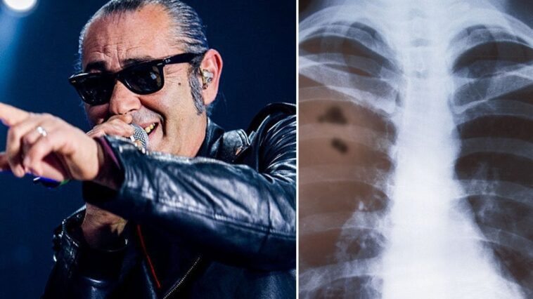 Quels sont les premiers symptômes d'un cancer du poumon et comment Luca Carboni a-t-il découvert la maladie 1 Quali sono i primi sintomi di un tumore al polmone e come ha fatto Luca Carboni a scoprire la malattia