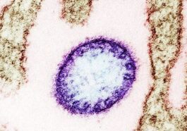 Une particule de virus Nipah observée au microscope électronique / Crédit : NIAD
