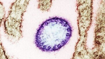Une particule de virus Nipah observée au microscope électronique / Crédit : NIAD