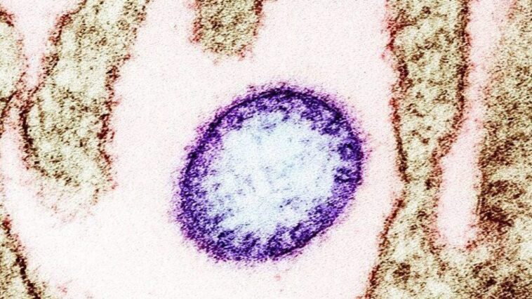 Qu'est-ce que le virus Nipah, les symptômes et comment se transmet l'infection qui a alarmé l'Inde 1 Une particule de virus Nipah observée au microscope électronique / Crédit : NIAD