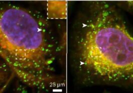 La perte de protéine Tau empêche la formation de gouttelettes lipidiques, utiles pour éliminer les substances toxiques dans le cerveau. Crédit : Nature Neuroscience