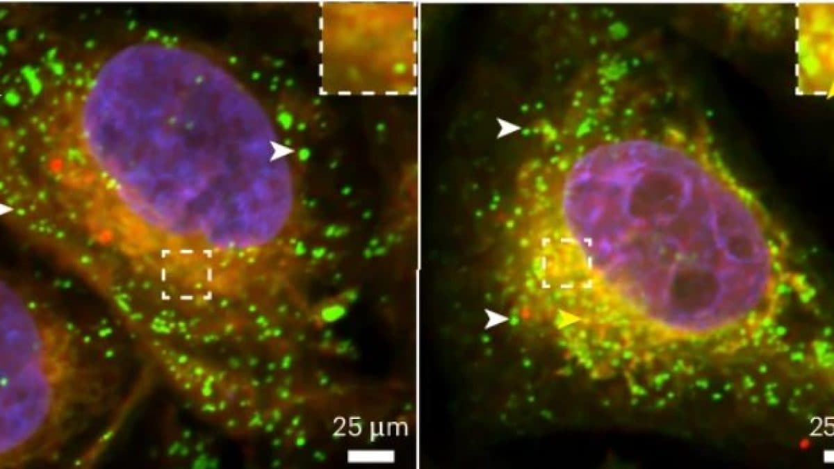 Un signal associé à l'Alzheimer peut en réalité protéger le cerveau : espoirs pour de nouvelles thérapies 2 La perte de protéine Tau empêche la formation de gouttelettes lipidiques, utiles pour éliminer les substances toxiques dans le cerveau. Crédit : Nature Neuroscience