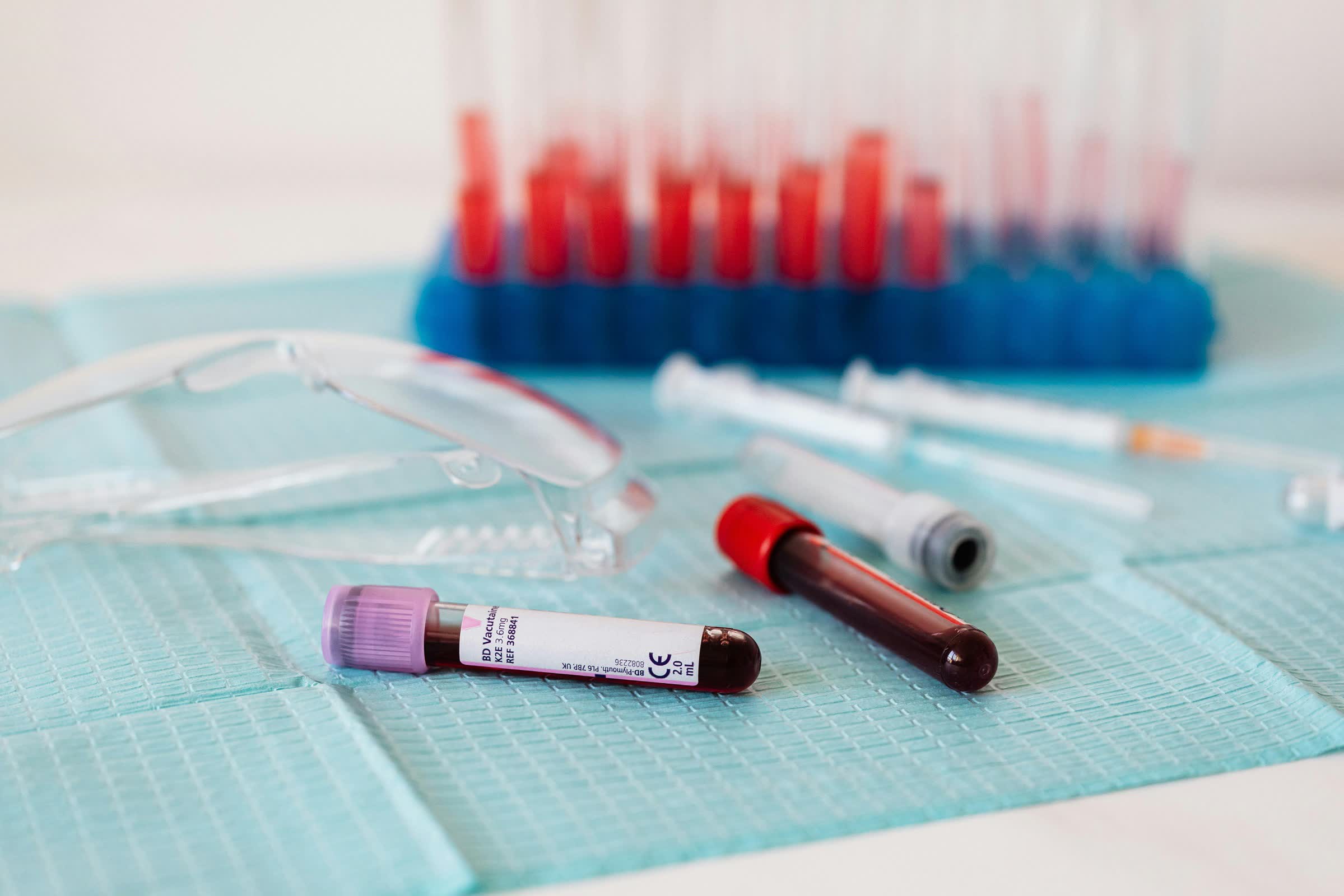 Un simple test sanguin peut prédire le risque de maladie cardiaque chez une femme des décennies à l'avance 2 Un simple test sanguin peut predire le risque de maladie