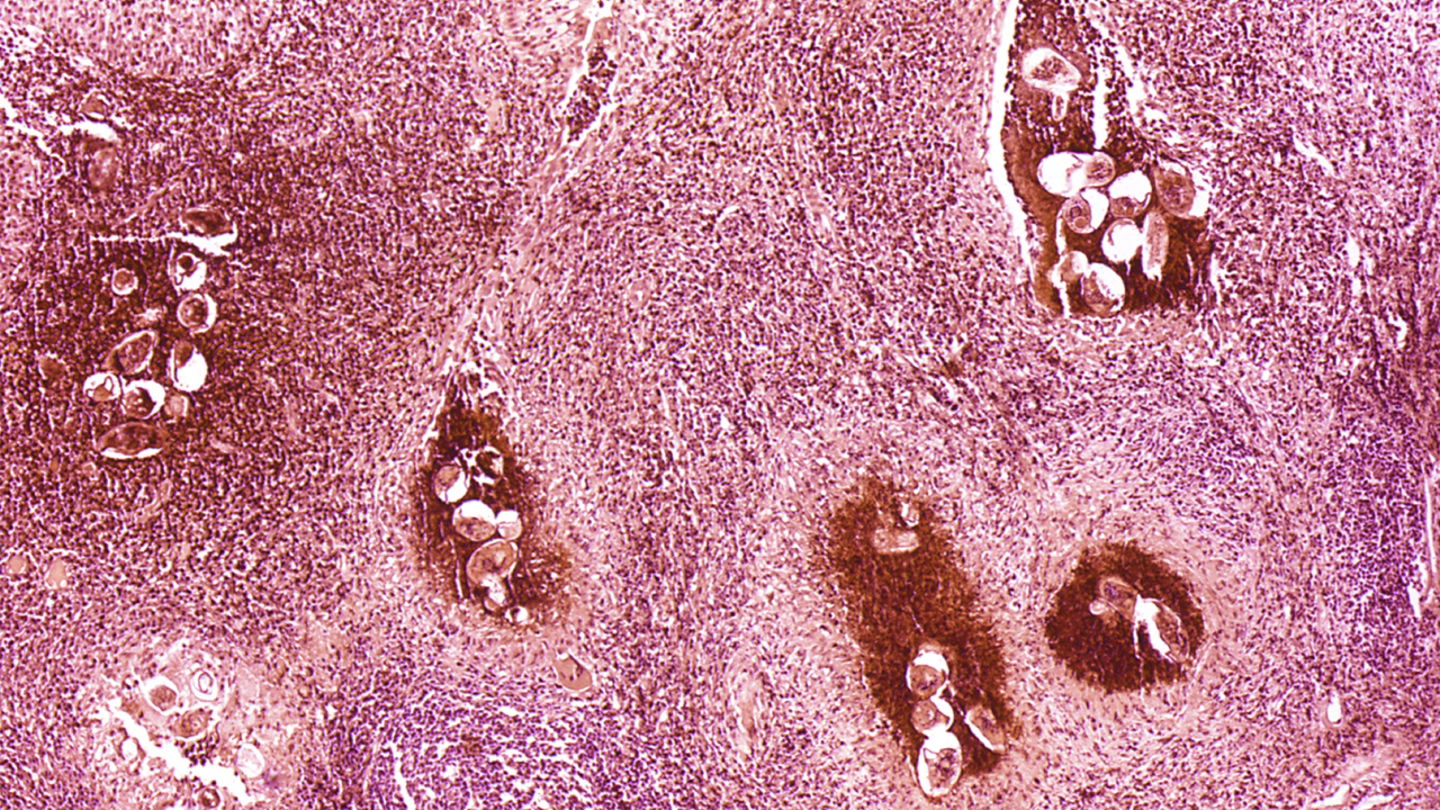 L'IA nous surprend à nouveau : elle est désormais capable de détecter des parasites 3 L'IA continue de nous surprendre : elle est maintenant capable de détecter des parasites