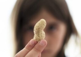 L'allergia alle arachidi è una delle allergia alimentari più comuni, che è la causa della maggior parte delle gravi reazioni allergiche e anafilassi associate al cibo / Photo Credit iStock