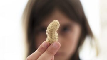 Allergie aux arachides : quels sont les symptômes d'une réaction allergique et pourquoi est-ce si dangereux ? 26 L'allergia alle arachidi è una delle allergia alimentari più comuni, che è la causa della maggior parte delle gravi reazioni allergiche e anafilassi associate al cibo / Photo Credit iStock