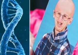 De quelle manière le corps de Sammy Basso aide la recherche sur la progeria : l'explication de la généticienne de Telethon 41 La decisione di Sammy Basso di donare il proprio corpo alla scienza può dare la possibilità di comprendere i meccanismi responsabili della progeria