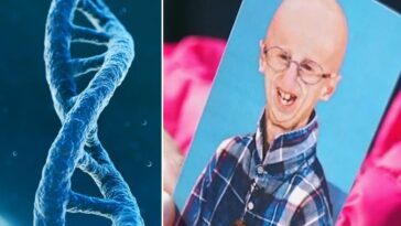 De quelle manière le corps de Sammy Basso aide la recherche sur la progeria : l'explication de la généticienne de Telethon 6 La decisione di Sammy Basso di donare il proprio corpo alla scienza può dare la possibilità di comprendere i meccanismi responsabili della progeria
