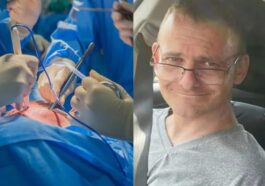 Déclaré en mort cérébrale, mais "revient à la vie" avant le prélèvement des organes : comment est-ce possible 56 Dichiarato in morte cerebrale, ma “torna in vita” prima del prelievo degli organi: com’è possibile