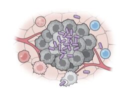 Les bactéries transformées en vaccin anticancer (violet) activent le système immunitaire contre les cellules tumorales (gris). Crédit : Columbia University