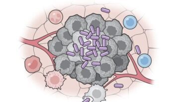 Des bactéries transformées en puissants vaccins anticancéreux : bloqués et éliminés des tumeurs metastatiques dans les tests 23 Les bactéries transformées en vaccin anticancer (violet) activent le système immunitaire contre les cellules tumorales (gris). Crédit : Columbia University