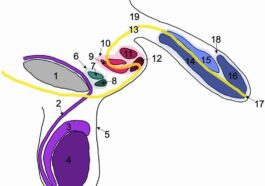 Le schéma des trois peni trouvés chez l'homme de 78 ans. En vert et rouge les deux peni supplémentaires, en jaune le trajet de l'urètre. Crédit: Buchanan et al./ Journal of Medical Case Reports