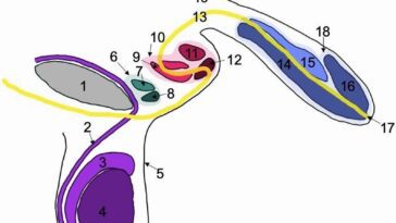 Homme avec trois pénis découvert par hasard au Royaume-Unis : c'est seulement le deuxième cas de triphallie connu à la science 24 Le schéma des trois peni trouvés chez l'homme de 78 ans. En vert et rouge les deux peni supplémentaires, en jaune le trajet de l'urètre. Crédit: Buchanan et al./ Journal of Medical Case Reports