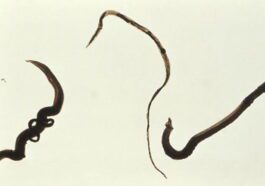 L'IA nous surprend à nouveau : elle est désormais capable de détecter des parasites 9 L'IA continue de nous surprendre : elle est maintenant capable de détecter des parasites