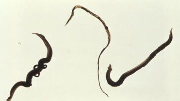 L'IA nous surprend à nouveau : elle est désormais capable de détecter des parasites 29 L'IA continue de nous surprendre : elle est maintenant capable de détecter des parasites