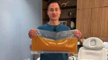 Le nouveau traitement de Brian Johnson, l'homme qui ne veut pas vieillir : "Mon plasma devient de l'or liquide" 16 Image