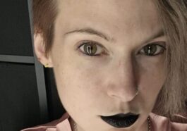 Que se cache derrière le drame de Phoenix : "J'ai la maladie du vampire. Si je mange de l'ail, je pourrais mourir" 61 Immagine
