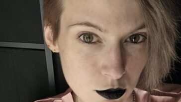 Que se cache derrière le drame de Phoenix : "J'ai la maladie du vampire. Si je mange de l'ail, je pourrais mourir" 9 Immagine