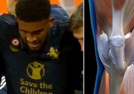 a sinistra, Gleison Bremer mentre lascia il campo in seguito all'infortunio al ginocchio sinistro durante la partita di Champions League a Lipsia