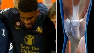 a sinistra, Gleison Bremer mentre lascia il campo in seguito all'infortunio al ginocchio sinistro durante la partita di Champions League a Lipsia