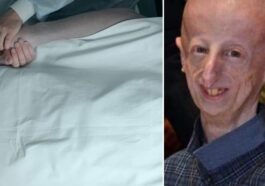 Sammy Basso, mort samedi dernier à 28 ans : il a donné son corps à la science pour aider la recherche à trouver un remède à la progeria de Hutchinson-Gilford