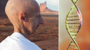 Sammy Basso, décédé à l’âge de 28 ans, avait la progeria, une maladie génétique rare causée par une mutation spontanée au gène LMNA / PhotoCredit: Association Française de Progeria Sammy Basso.