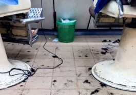 Coiffeurs négligés et de mauvaise qualité, explosion des cas de dermatite du cuir chevelu en Angleterre 13 Immagine