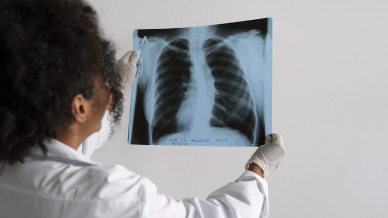 Combien de temps faut-il aux poumons pour retrouver une respiration saine après avoir arrêté de fumer ? 1 Immagine