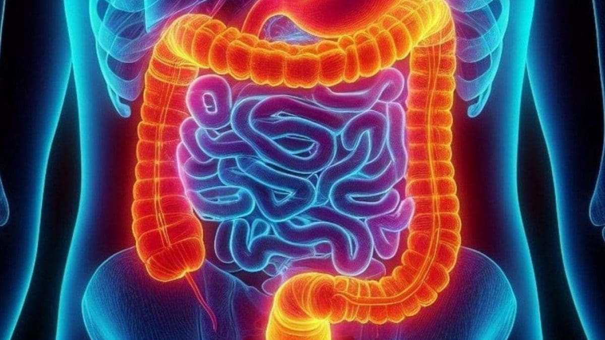 Découverte d'une protéine essentielle dans le cancer du côlon : sa présence révèle les patients peu sensibles à la chimiothérapie 2 Image