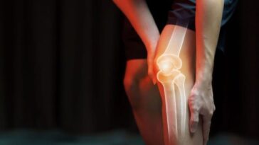 Développée en laboratoire, une "cartilage artificiel" : comment il peut transformer le traitement de l'arthrite 17 Immagine
