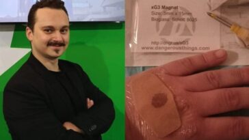 Mattia Coffetti, l'homme aux cinq puces dans le corps, maintenant sous enquête pour vol de données 7 Immagine