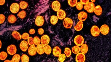 Monkeypox (mpox) : un nouveau cas autochtone au Royaume-Unis, découvrez les symptômes et les modes de transmission du virus 17 Particules de mpox, le virus du monkeypox qui a déclenché la nouvelle urgence sanitaire mondiale avec le nouveau clade 1b / Photo Credit NIAID